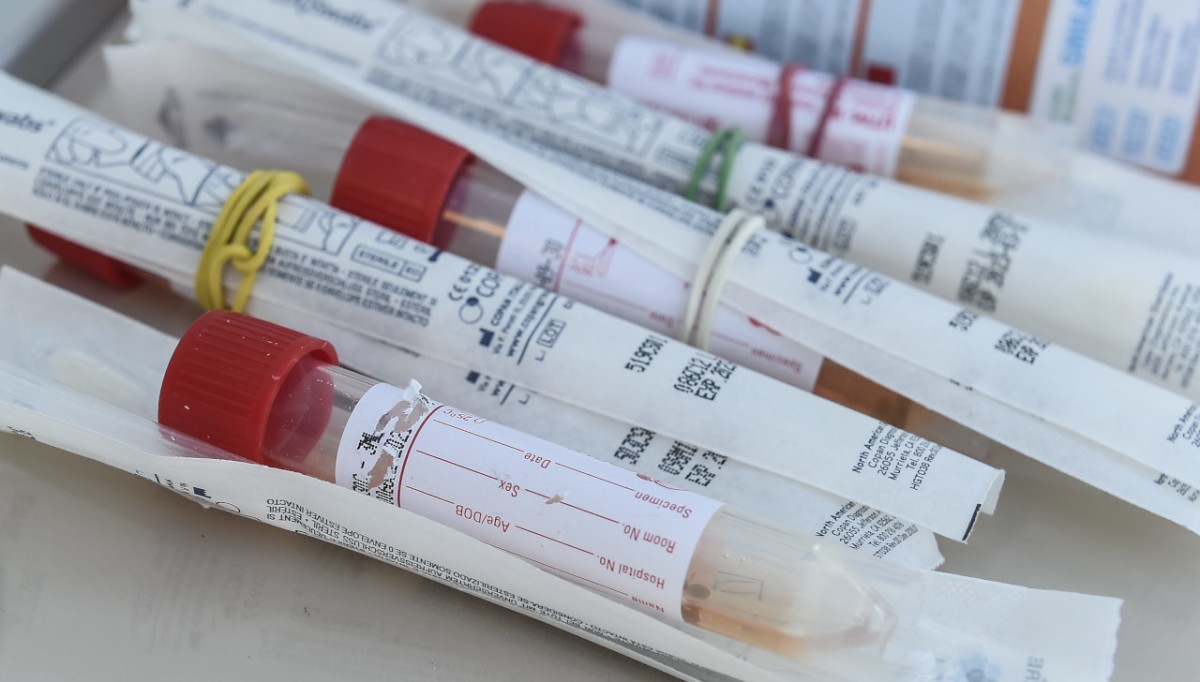 Screening oncologici, ASL Bari e Federfarma insieme per favorire l’adesione dei cittadini ai programmi di prevenzione